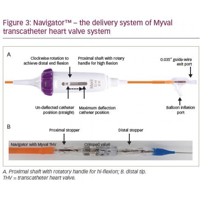 Myval™ Aortic Valve Bioprosthesis TAVR